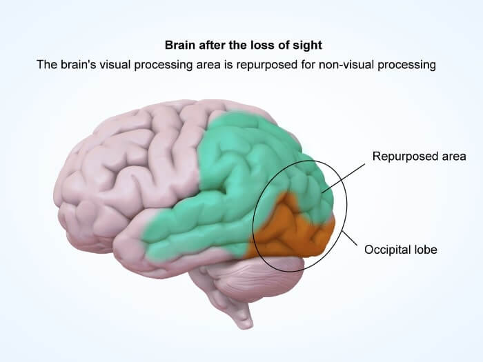 Illustration of the human brain after sight loss from UWorld's AP course